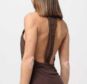 Nanushka Irina Bodysuit 5